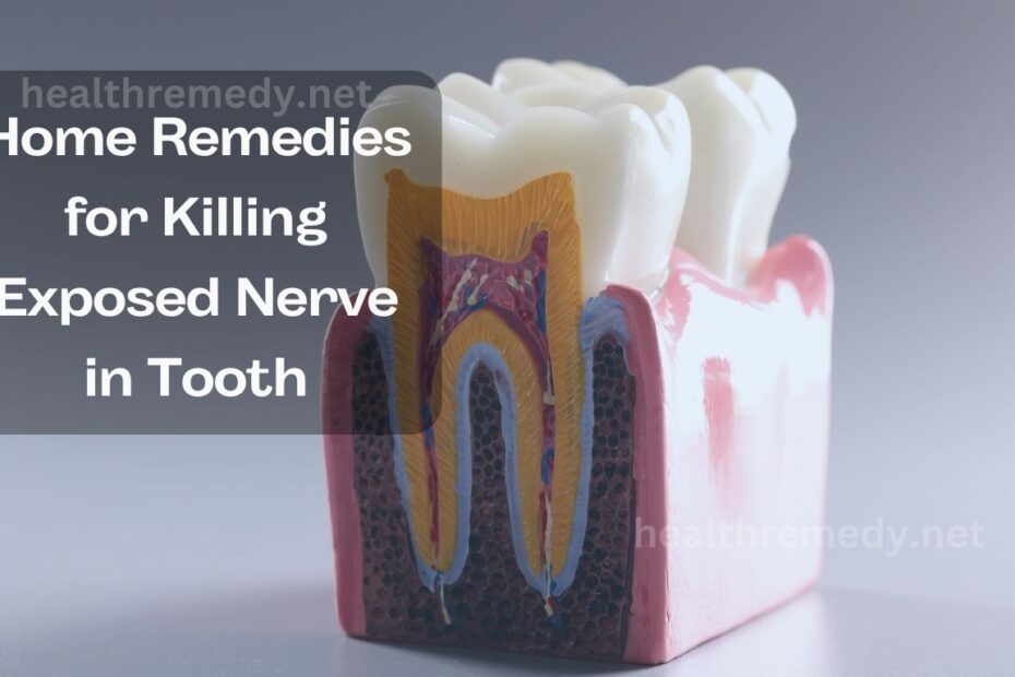 home remedies for killing exposed nerve in tooth